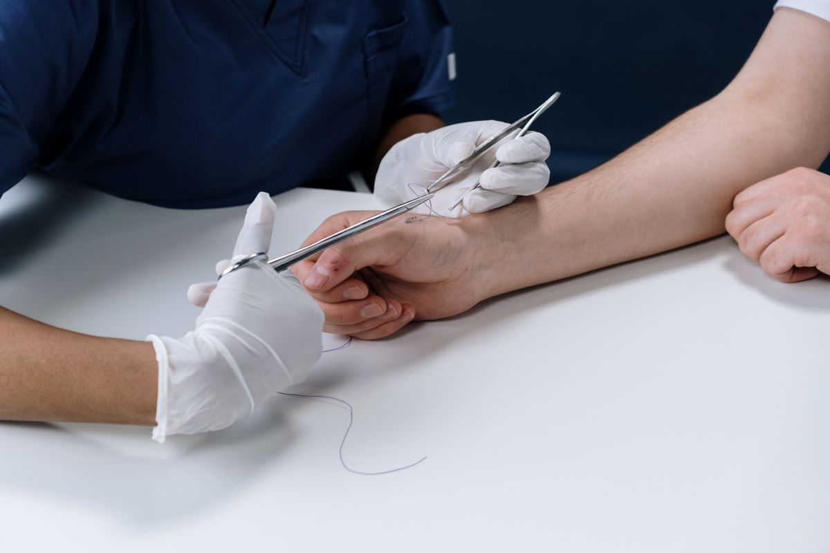 Zor Kolesistektomilerde Kapama Tekniği: Endoloop mu, Dikensiz (Barbed) Sütür mü?